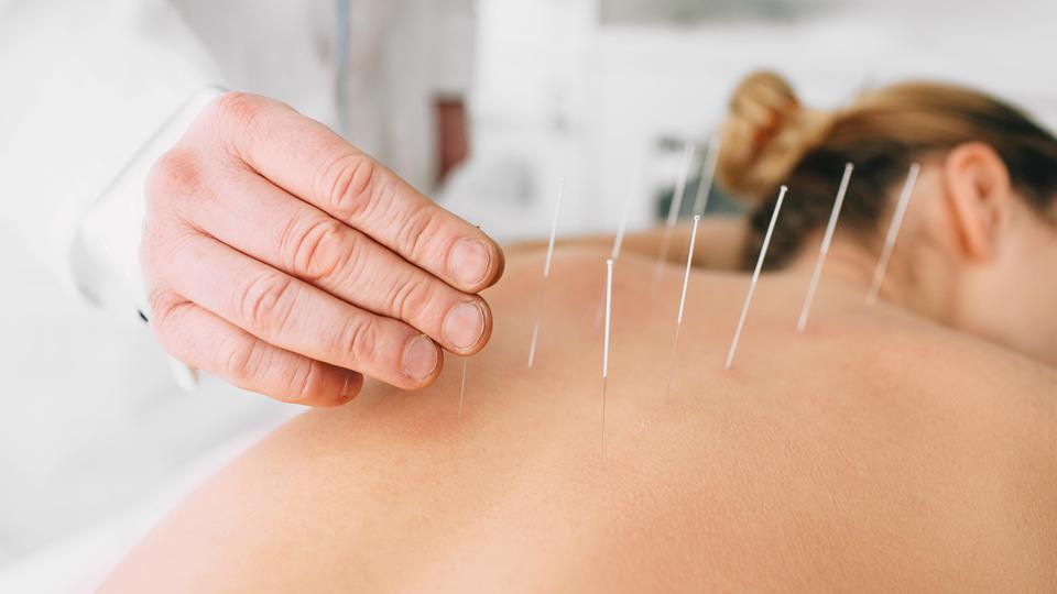 Acupuncture work for pain