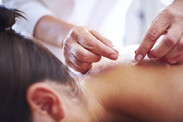 The Benefits Of Acupuncture For Anxiety Relief: What You Need To Know FIT Clinic The Benefits Of Acupuncture For Anxiety Relief: What You Need To Know