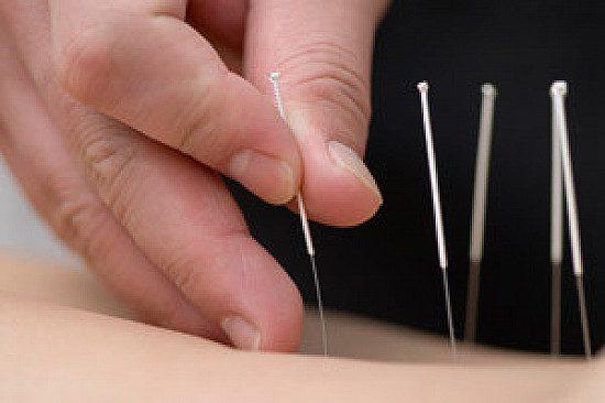 How does Acupuncture work for pain?