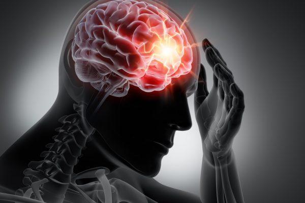How Serious Is A Concussion?